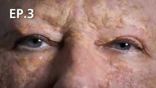 EP.03 | The Bad Skin Clinic Season 5