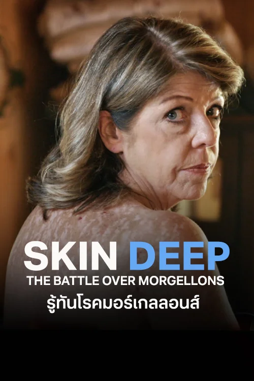 その他 Skin Deep: The Battle Over Morgellons [DVD] Skin Deep The Battle Over Morgellons - Watch Movies Online