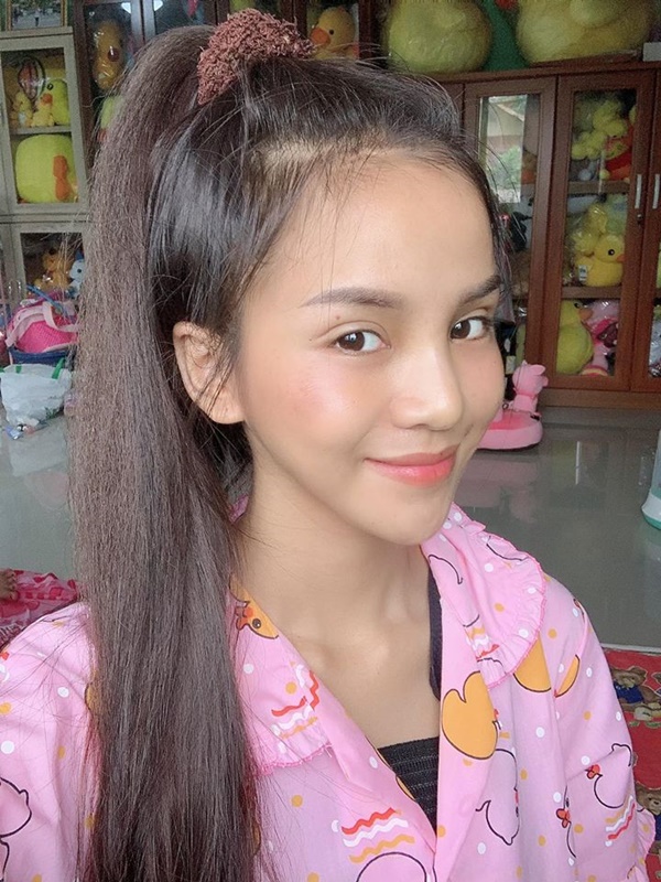 อาม ชุติมา หลังแก้จมูก 6 วัน