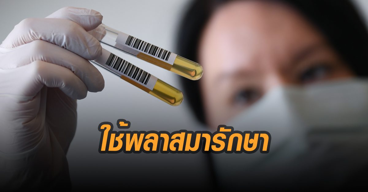 รพ.ในอังกฤษเริ่มทดสอบรักษาโควิด-19 ด้วยพลาสมาของคนหายป่วย