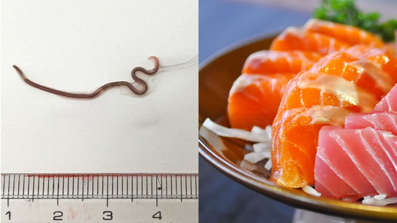 สาวญี่ปุ่นกิน “ซาชิมิ” เจ็บ-ระคายคอ หมอช็อก “พยาธิตัวกลม” ดิ้นอยู่ในต่อมทอนซิล