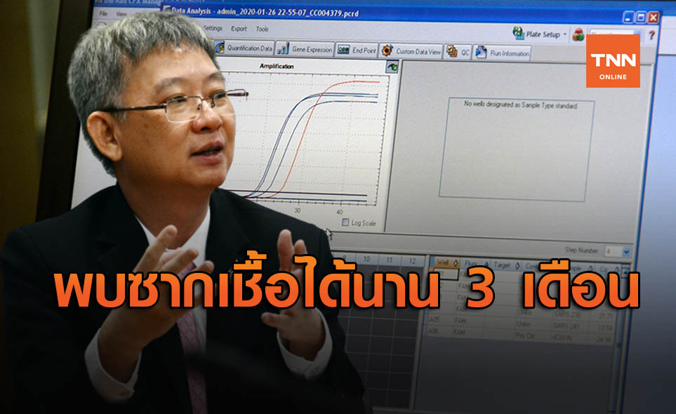กรมวิทย์ฯ ชี้ เรื่องปกติเจอซากเชื้อโควิด ตรวจพบได้นาน 3 เดือน