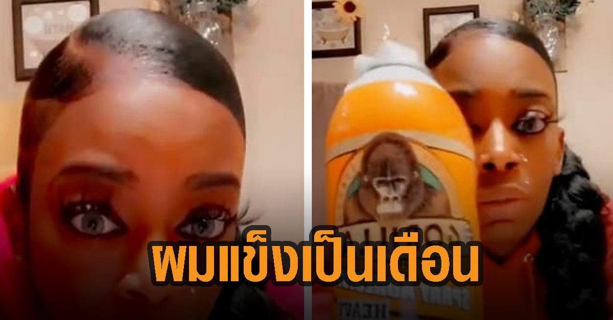อย่าหาทำ! หญิงมะกัน ใช้สเปรย์กาวพลังช้างแทนสเปรย์ฉีดผม อยู่ทรงเป็นเดือน สุดท้ายต้องเข้าร.พ.