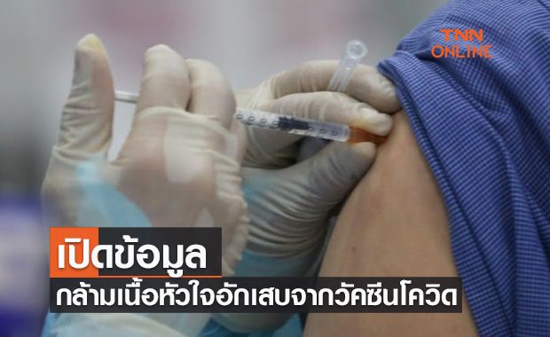 ราชวิทยาลัยอายุรแพทย์ฯเปิดข้อมูล กล้ามเนื้อหัวใจอักเสบจากวัคซีนโควิด-19 ราชวิทยาลัยอายุรแพทย์ฯเปิดข้อมูล กล้ามเนื้อหัวใจอักเสบจากวัคซีนโควิด-19