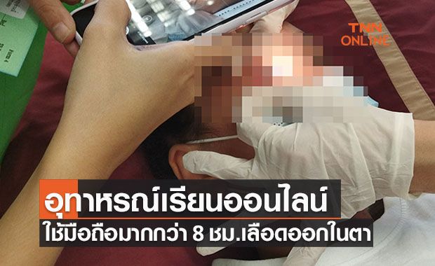 แม่โพสต์อุทาหรณ์! ลูกสาวเรียนออนไลน์-เล่นโทรศัพท์ เลือดออกในตา แม่โพสต์อุทาหรณ์! ลูกสาวเรียนออนไลน์-เล่นโทรศัพท์ เลือดออกในตา
