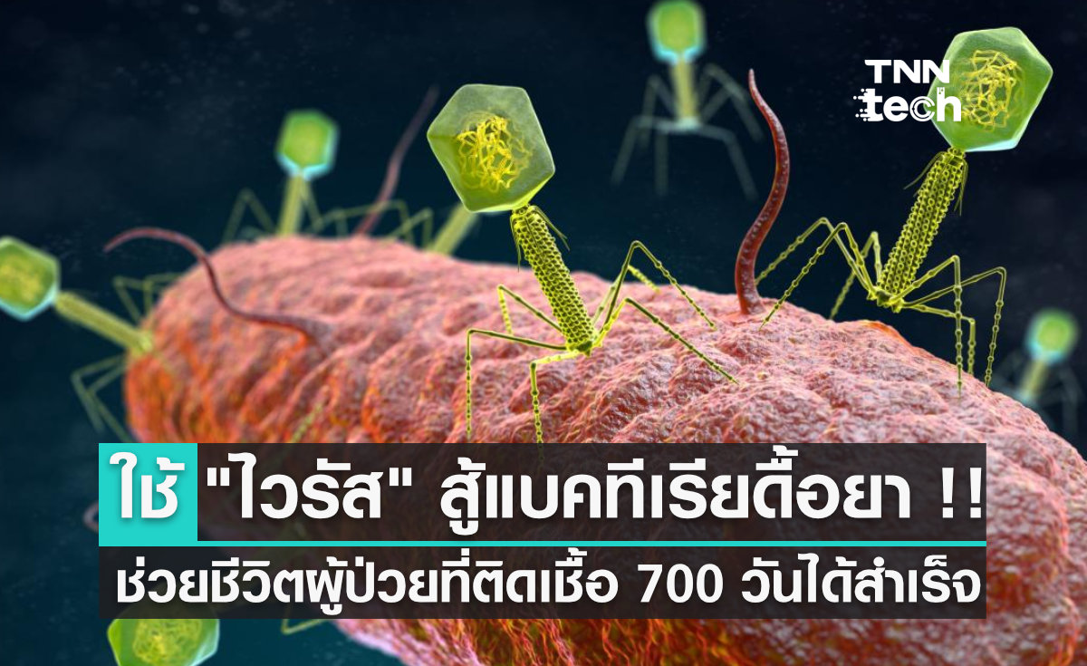 นักวิจัยใช้ "ไวรัส" สู้แบคทีเรียดื้อยา จนช่วยชีวิตผู้ป่วยที่ติดเชื้อนาน 700 วันได้สำเร็จ
