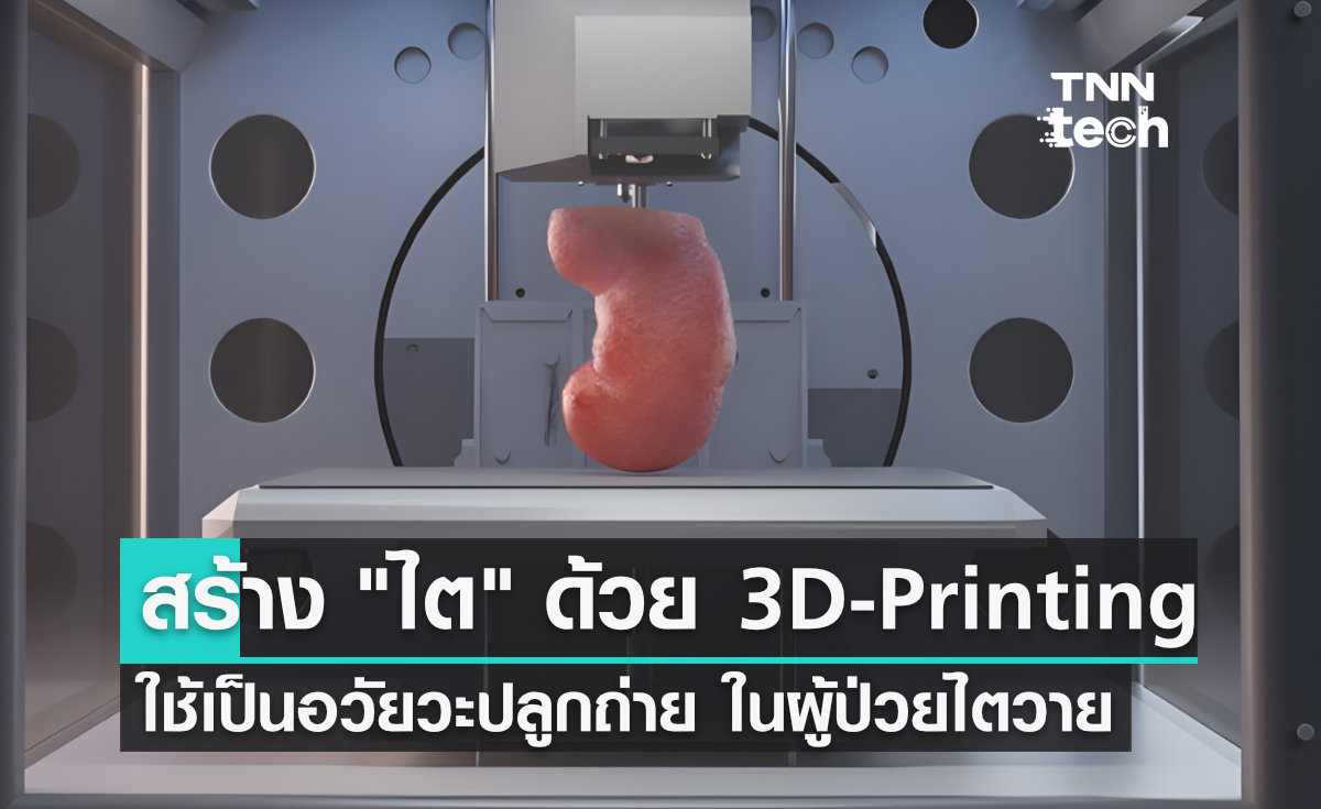 สร้าง "ไต" ด้วย 3D-printing เพื่อใช้เป็นอวัยวะปลูกถ่ายในผู้ป่วยไตวายเรื้อรัง