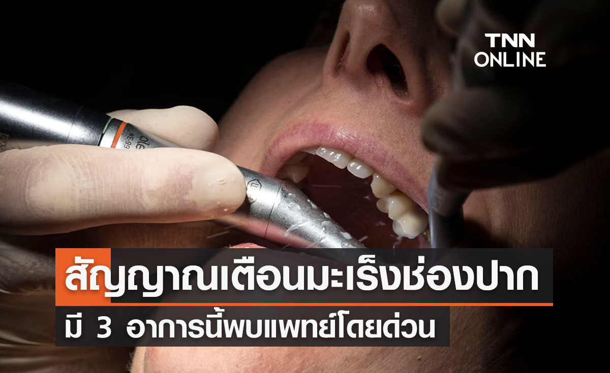 เปิด 3 สัญญาณอันตรายเสี่ยงเป็นมะเร็งช่องปาก ต้องรีบพบแพทย์รักษาด่วน