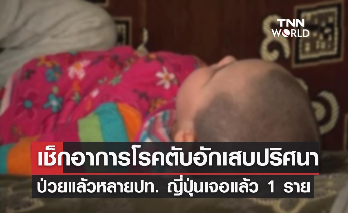 เช็กอาการ "โรคตับอักเสบปริศนา" ล่าสุดเจอที่ญี่ปุ่นเป็นรายแรกในเอเชีย!