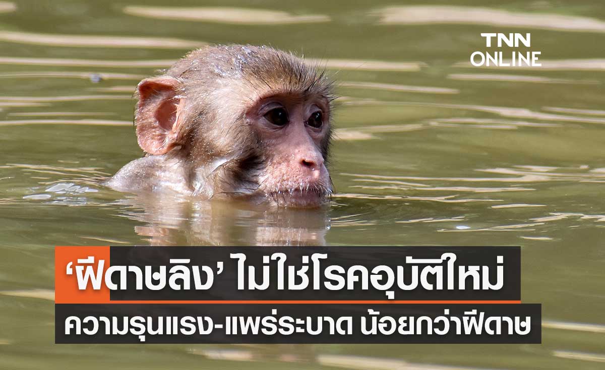 หมอยง เผย "ฝีดาษลิง" ยังไม่พบในไทย ความรุนแรง-การแพร่ระบาดน้อยกว่าฝีดาษมาก