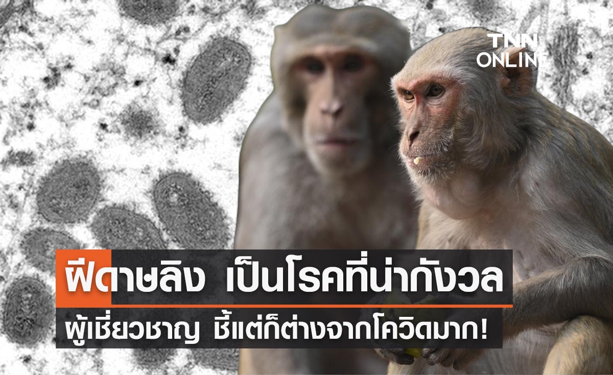 ผู้เชี่ยวชาญเผยถึง "ฝีดาษลิง" จะเป็นโรคระบาดที่น่ากังวล แต่ต่างจากโควิด!