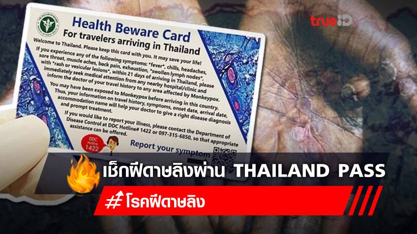 เตรียมคัดกรอง "ฝีดาษลิง" ผ่านระบบ "Thailand Pass" สำหรับนักท่องเที่ยวเดินทางเข้าไทย