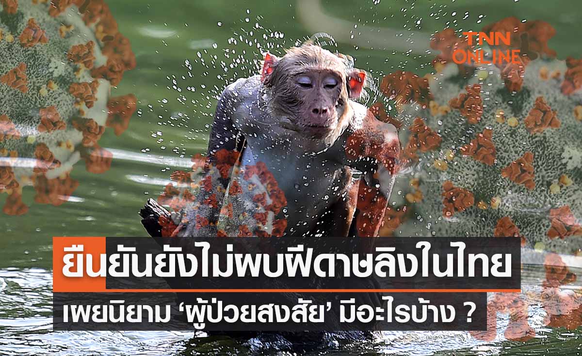 ฝีดาษลิงในไทย รบ.ยืนยันไม่พบติดเชื้อ พร้อมเผยนิยาม “ผู้ป่วยสงสัย”