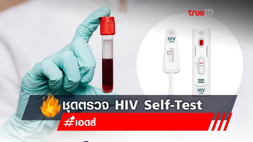 ไฟเขียว! ชุดตรวจ HIV Self-Test ช่วยกลุ่มเสี่ยงรู้ผลไว เข้าถึงการรักษาเร็ว