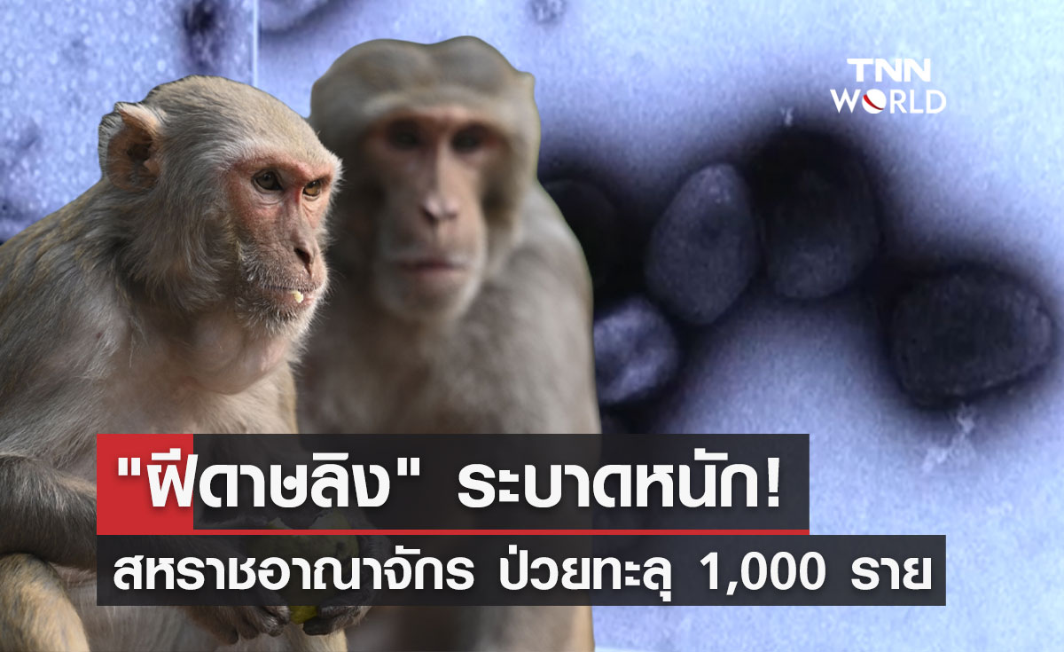 "ฝีดาษลิง" ระบาด! สหราชอาณาจักรพบผู้ป่วยทะลุ 1,000 รายแล้ว