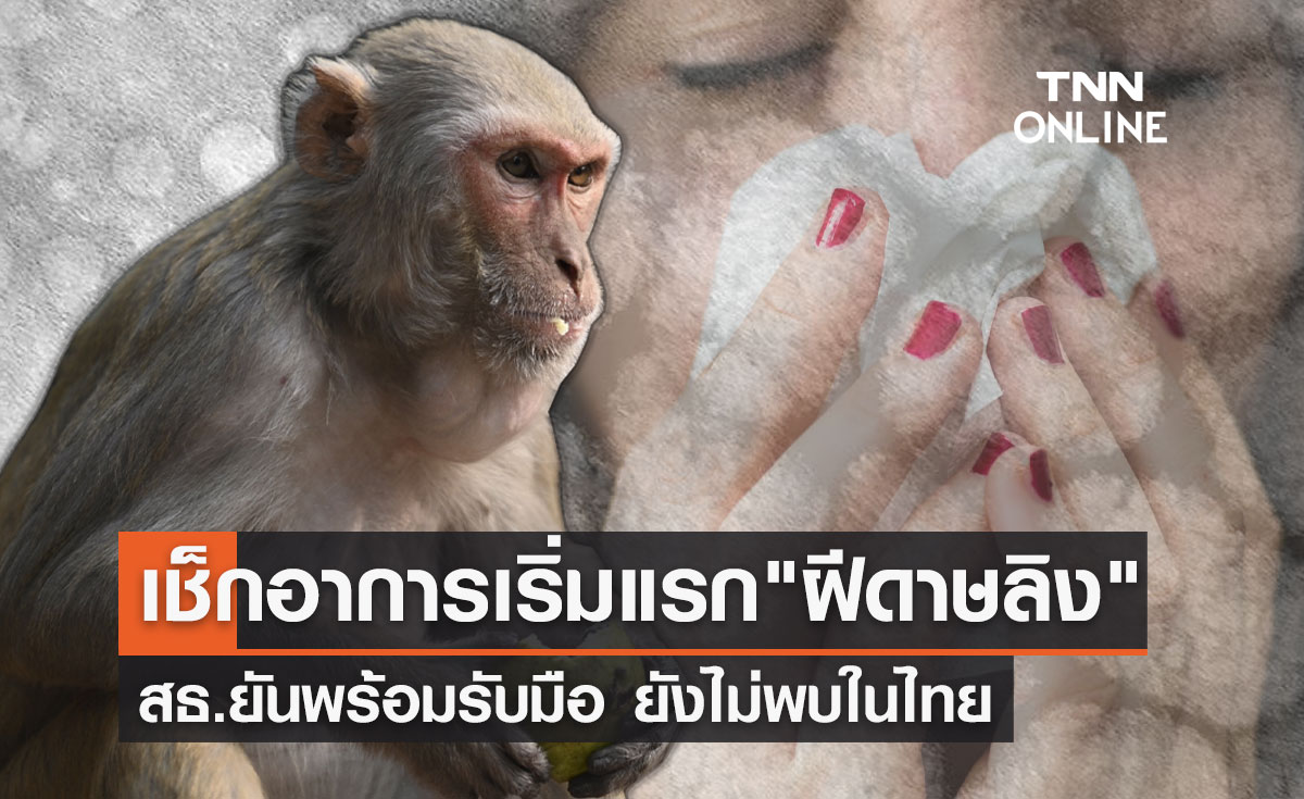 "ฝีดาษลิง" ยังไม่พบในไทย อาการเริ่มแรกเป็นอย่างไรเช็กเลย!