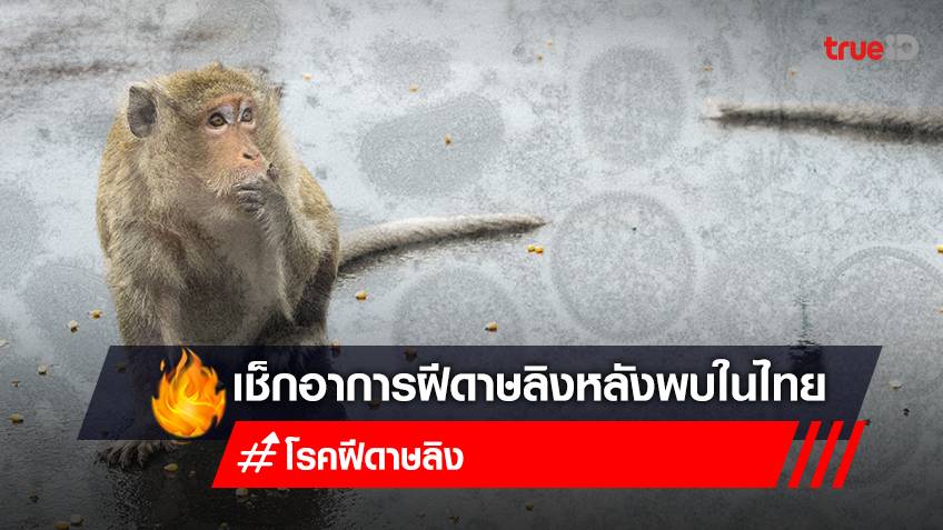 เช็ก "อาการฝีดาษลิง" หลังไทยพบผู้ติดเขื้อ "โรคฝีดาษลิง" (Monkeypox) รายแรกที่ภูเก็ต ติดจริง มีอาการอย่างไร
