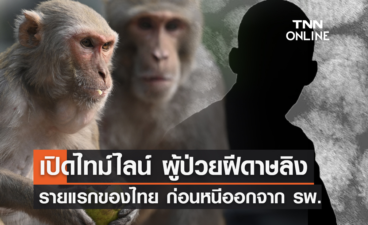 เปิดไทม์ไลน์ ผู้ป่วย "ฝีดาษลิง" รายแรกของไทย ก่อนหนีออกจาก รพ.