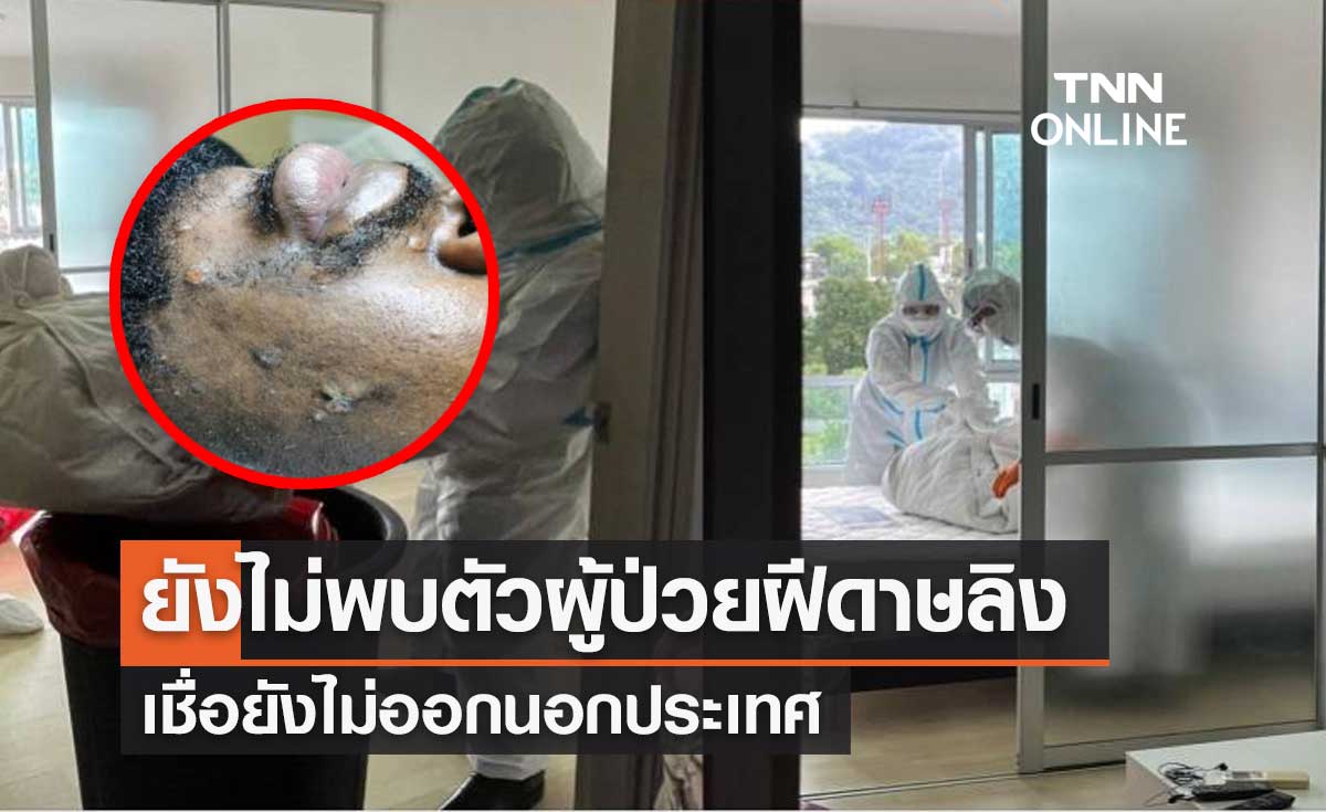 แถลงด่วน! "ฝีดาษลิง" รายแรกของไทยที่ภูเก็ต ยังไม่พบตัว เชื่อยังไม่ออกนอกประเทศ