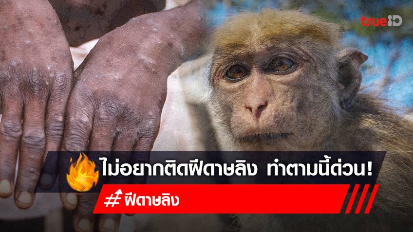 วิธีป้องกันฝีดาษลิง-อาการฝีดาษลิง หลังพบผู้ป่วยฝีดาษลิงในไทย ไม่อยากติด "ฝีดาษลิง" ทำตามนี้