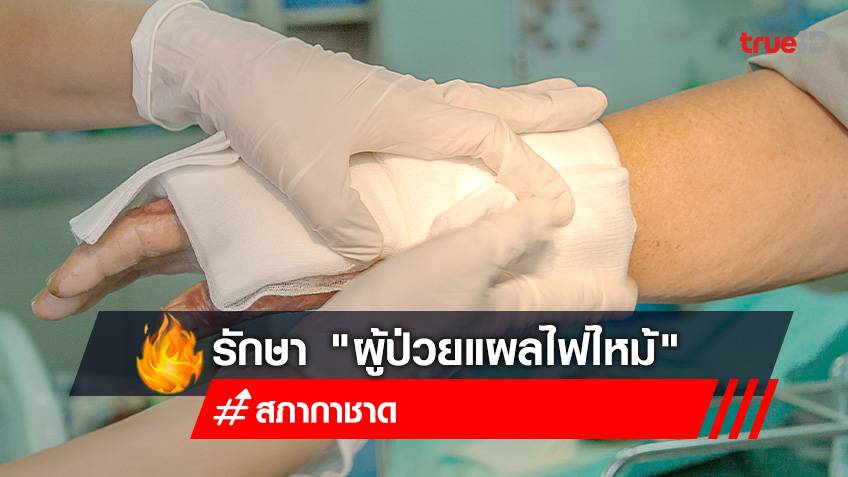 เผยแนวทางรักษา "ผู้ป่วยแผลไฟไหม้" เบิกผิวหนังใหม่ที่สภากาชาดไทย