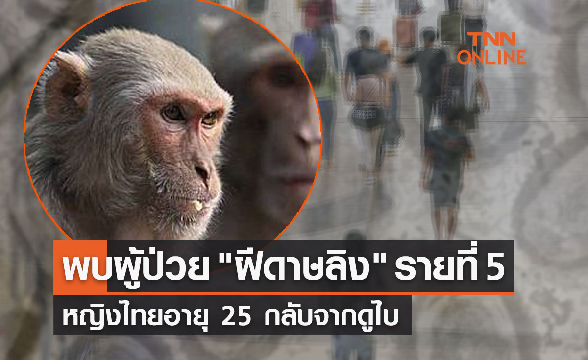 ด่วน! สธ.พบผู้ป่วย "ฝีดาษลิง" รายที่ 5 หญิงไทยอายุ 25 กลับจากนครดูไบ