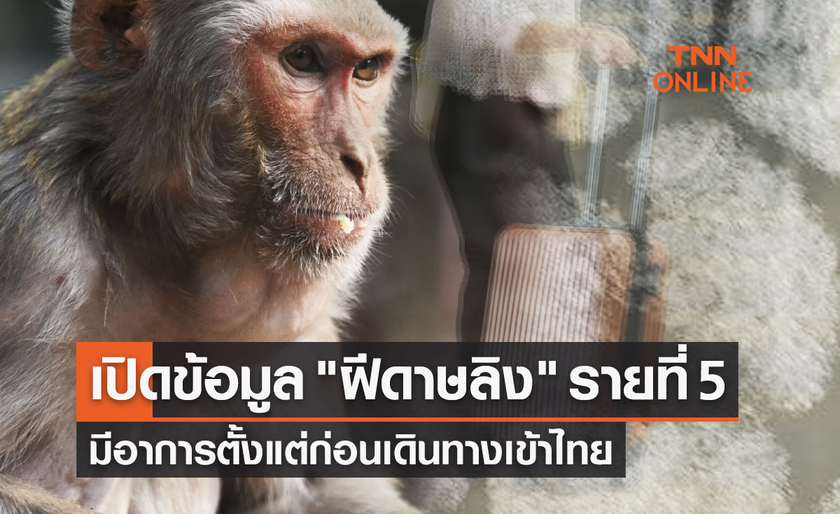 เปิดข้อมูล "ฝีดาษลิง" รายที่ 5 มีอาการตั้งแต่ก่อนเดินทางเข้าไทย