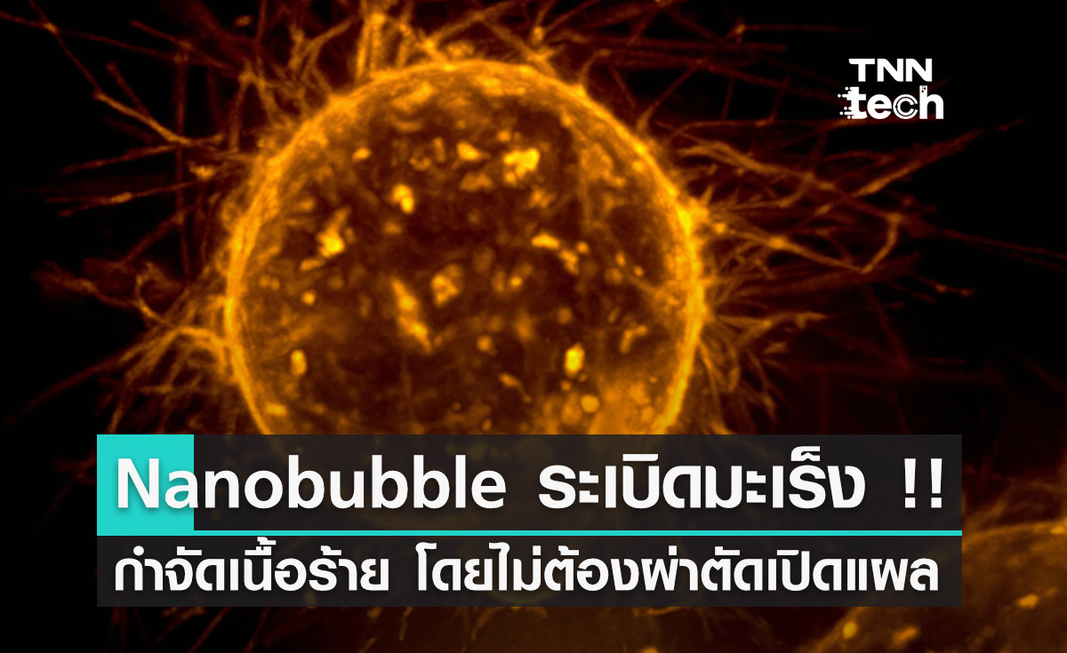 Nanobubble กำจัดก้อนมะเร็งด้วยการ "ระเบิด" โดยไม่ต้องผ่าตัดเปิดแผล