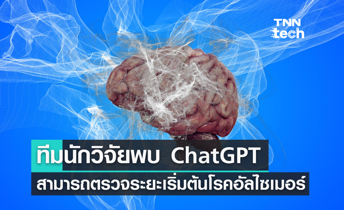 ChatGPT เขย่าโลก !  สามารถช่วยตรวจหาระยะเริ่มต้นของโรคอัลไซเมอร์