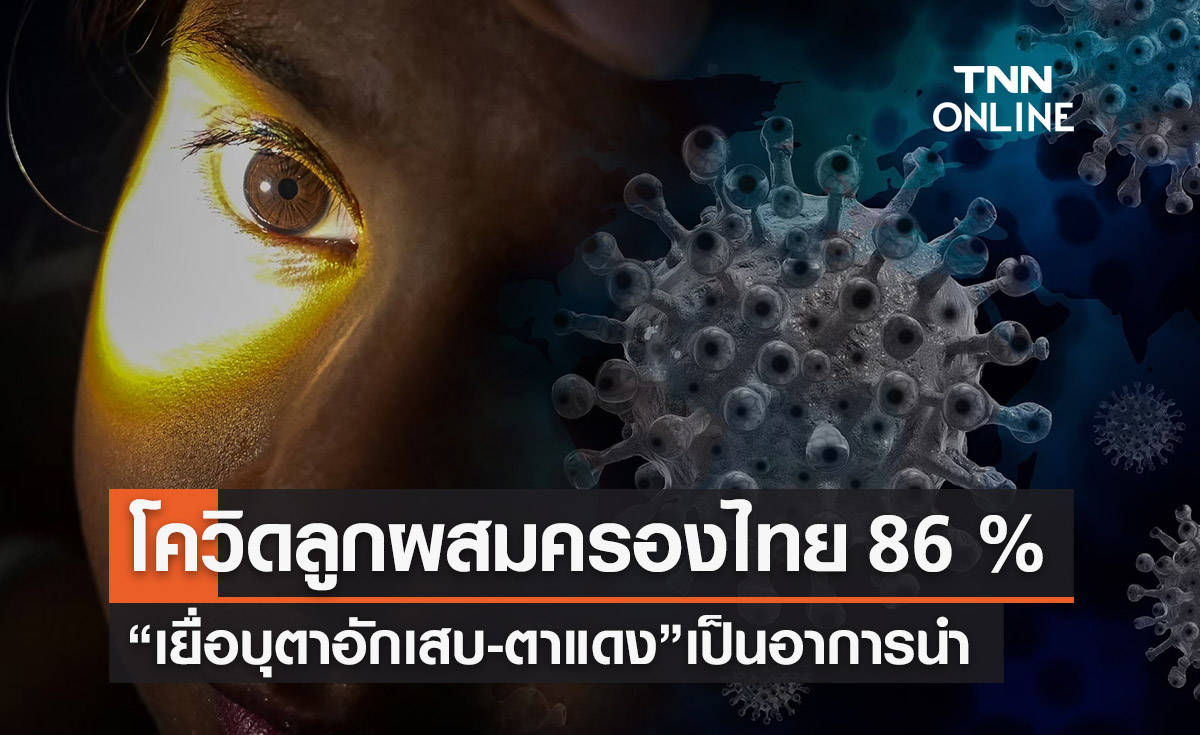 โควิด-19 ลูกผสมครองไทย 86.8% “เยื่อบุตาอักเสบ-ตาแดง” อาการนำติดเชื้อ