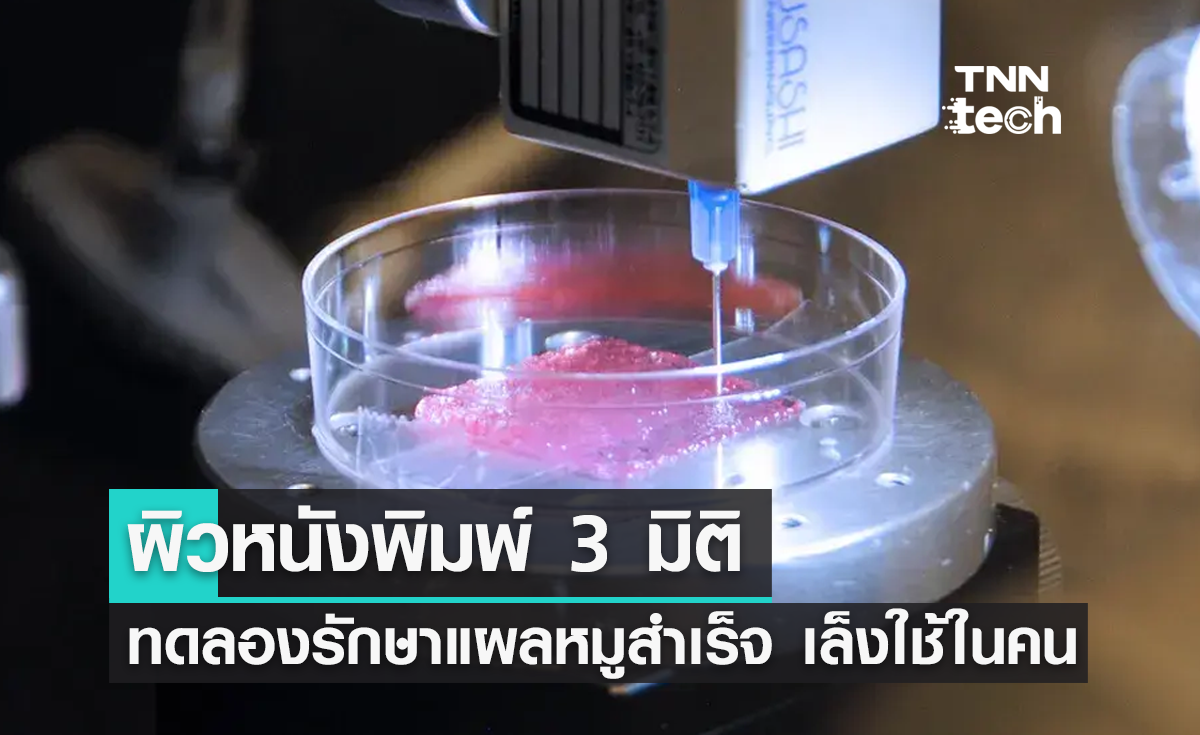 นักวิจัยพัฒนาผิวหนังพิมพ์ 3 มิติ ทดลองรักษาแผลหมูสำเร็จ เล็งใช้รักษามนุษย์ในอนาคต