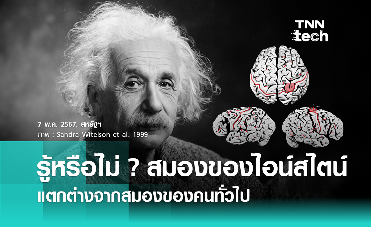 เจาะสมองอัจฉริยะ ! รู้หรือไม่ ? สมองของไอน์สไตน์  แตกต่างจากสมองของคนทั่วไป