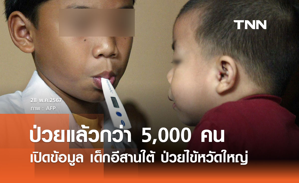 ไข้หวัดใหญ่ระบาด! พบ เด็กอีสานใต้ ป่วยแล้วกว่า 5,000 คน