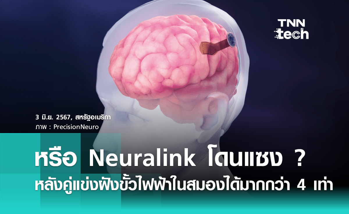 หรือ Neuralink จะโดนแซง ? หลังคู่แข่งฝังขั้วไฟฟ้าในสมองได้มากกว่าถึง 4 เท่า