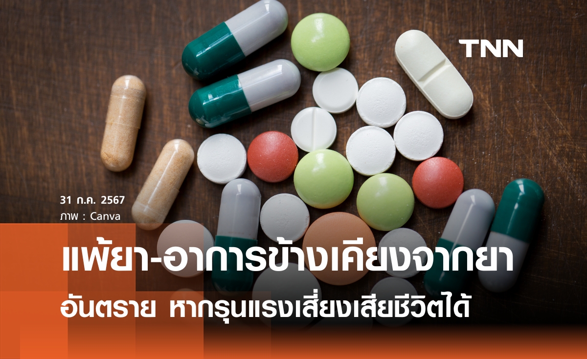 ไขข้อสงสัย "แพ้ยา-ผลข้างเคียงจากการใช้ยา" ต่างกันอย่างไร หากรุนแรงอันตรายเสี่ยงเสียชีวิต