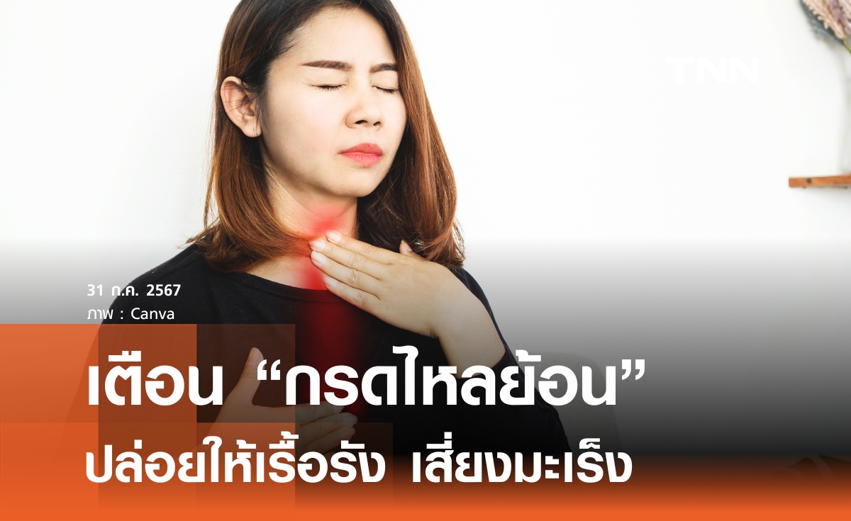 "กรดไหลย้อน" ภัยสุขภาพไม่ควรมองข้าม