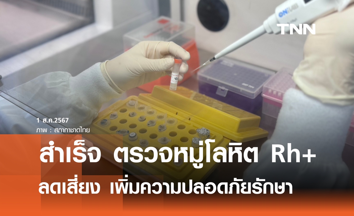 ศูนย์บริการโลหิตฯ พัฒนาการตรวจหมู่โลหิตหมู่พิเศษ Rh+ สำเร็จ