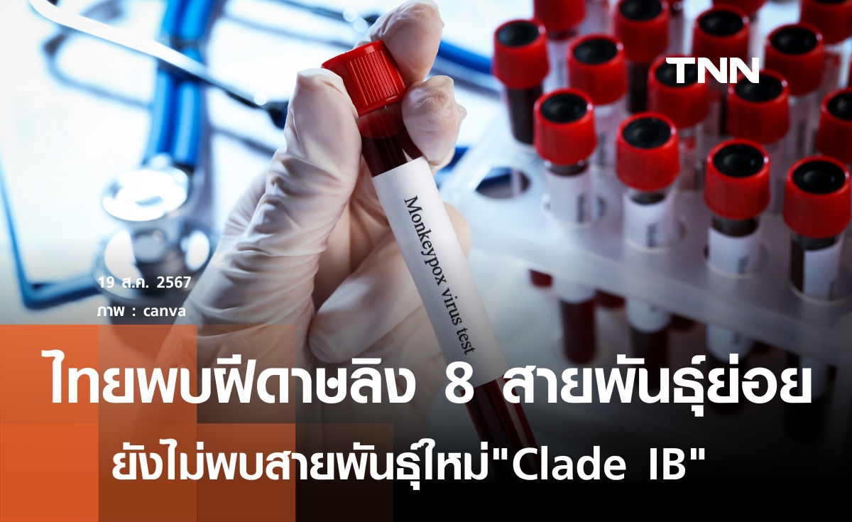 ไทยพบฝีดาษลิง 8 สายพันธุ์ย่อย ยังไม่พบสายพันธุ์ใหม่"Clade IB"