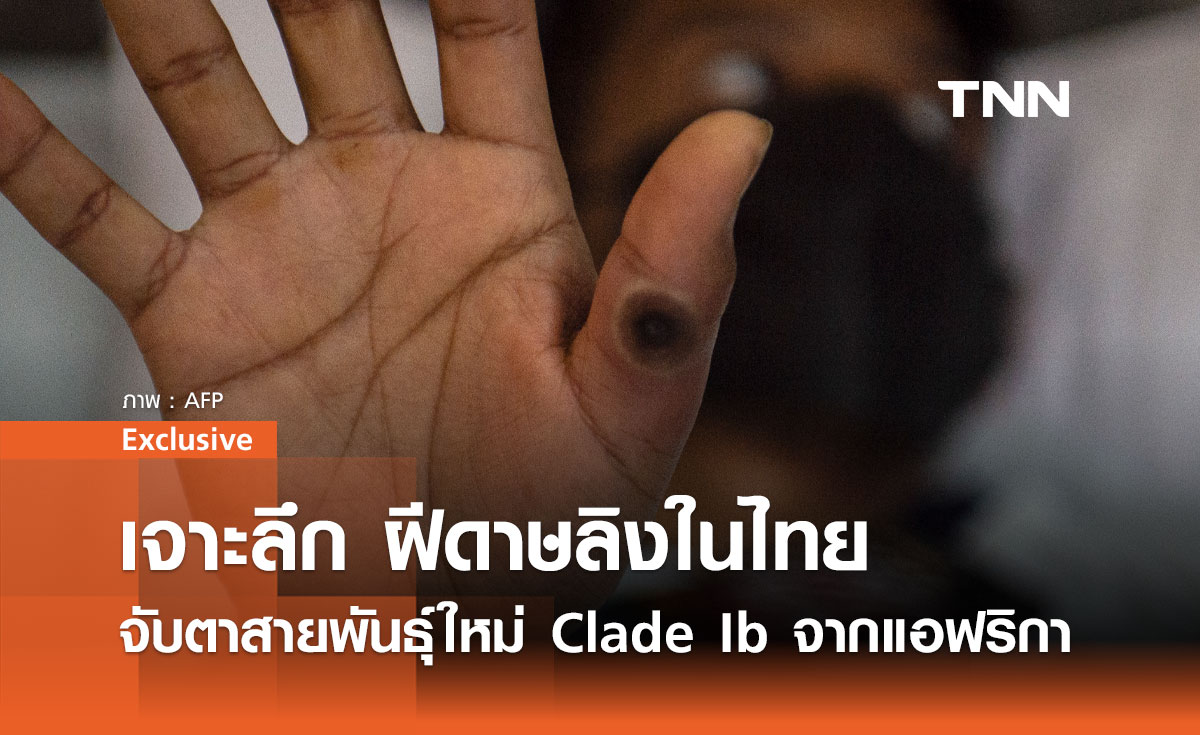 เจาะลึกสถานการณ์ฝีดาษลิงในไทย: จับตาสายพันธุ์ใหม่ Clade Ib จากแอฟริกา