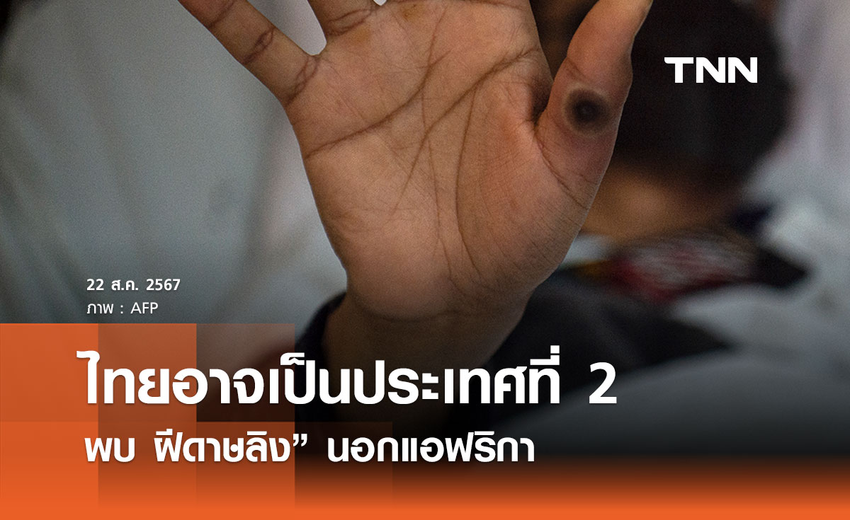 รอผลยืนยันสายพันธุ์! ไทยอาจเป็นประเทศที่ 2 พบ “ฝีดาษลิง” นอกแอฟริกา