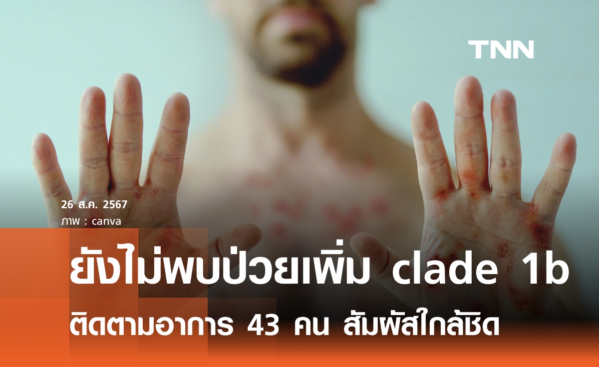 ยังไม่พบฝีดาษลิง clade 1b เพิ่ม  ติดตามอาการ 43 คนสัมผัสใกล้ชิด