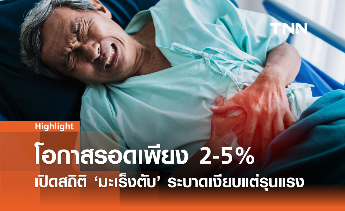 เจาะสถิติสูงชัน! มะเร็งตับ คร่าชีวิตคนไทย 21.4% ของมะเร็งทั้งหมด