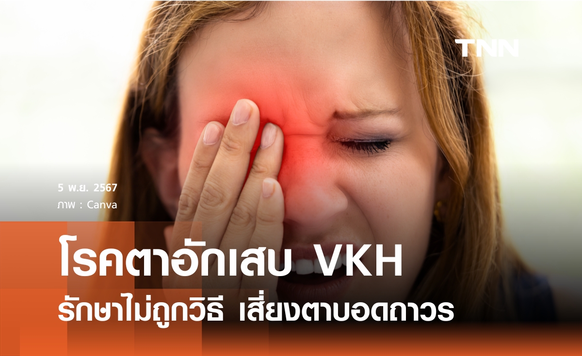 อันตรายโรคตา VKH รักษาที่ถูกวิธี เสี่ยงตาบอดถาวร