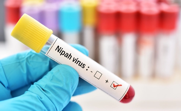 รู้จัก "ไวรัสนิปาห์" 1 ใน 13 โรคติดต่ออันตราย เช็กอาการ วิธีป้องกัน รู้จัก "ไวรัสนิปาห์" 1 ใน 13 โรคติดต่ออันตราย เช็กอาการ วิธีป้องกัน
