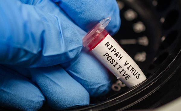 รัฐบาลเฝ้าระวัง “ไวรัสนิปาห์” กำชับด่านคัดกรองเข้ม - ไทยยังปลอดเชื้อ