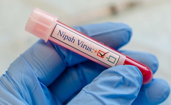 กรมการแพทย์ ย้ำยังไม่พบติดเชื้อไวรัสนิปาห์ในประเทศไทย