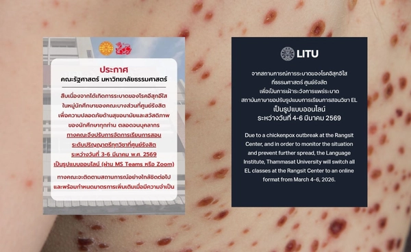 อีสุกอีใส ระบาด มธ.รังสิต สั่งเรียนออนไลน์ ลดเสี่ยงแพร่เชื้อ