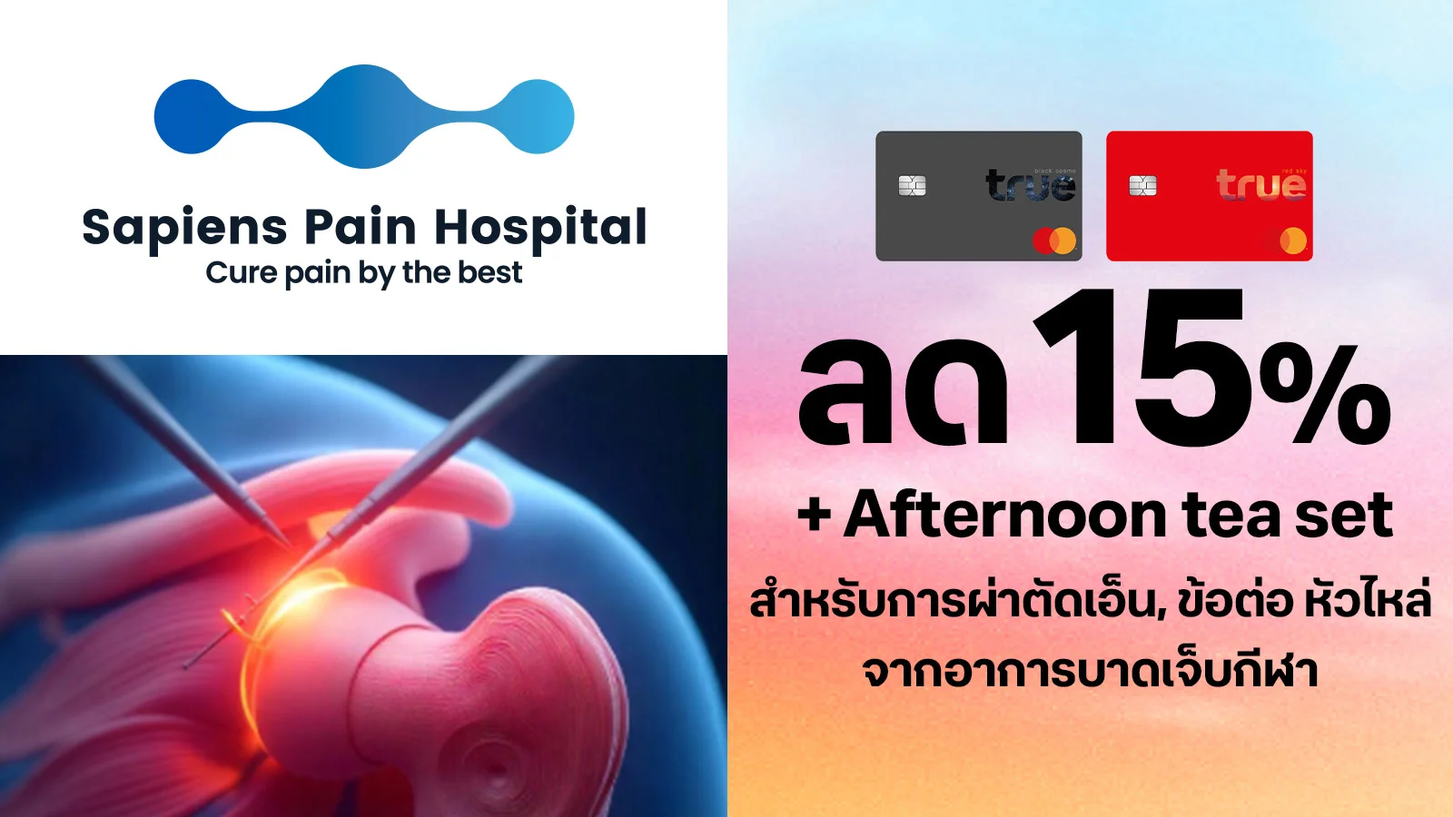 True Black and True Red customers receive a 15% discount on shoulder tendon and shoulder joint surgery for sports injuries. Use 0 True Points