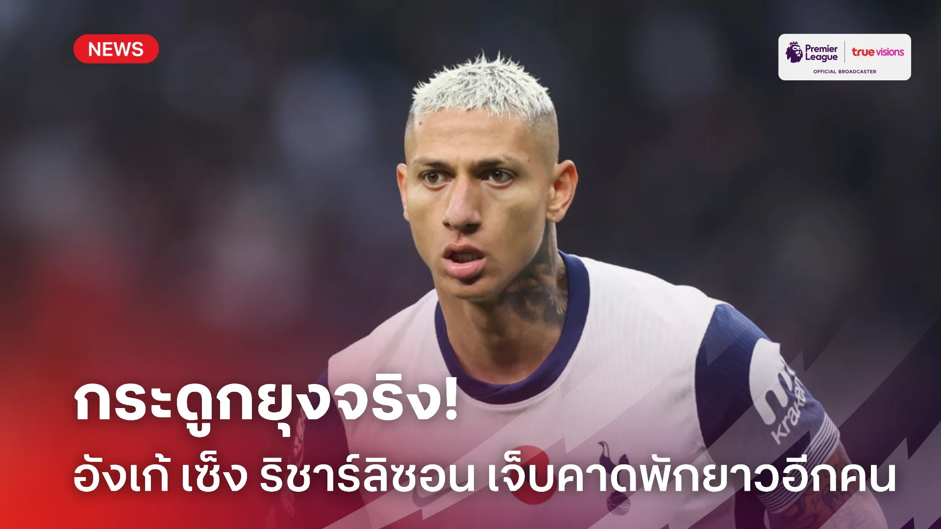 เข้าโรงหมอ.! อังเก้ สุดเซ็ง ริชาร์ลิซอน เจ็บน่องคาดพักยาวอีกหน