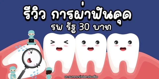 รีวิว ผ่าฟันคุด โรงพยาบาลรัฐ สิทธิบัตรทอง 30 บาท ดีหรือไม่ดี?